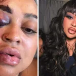 o-que-aconteceu-com-rizia-cerqueira?-ex-bbb-mostra-rosto-machucado-e-detalha-acidente-–-nsc-total