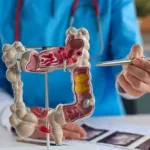 microbioma-intestinal-e-alvo-de-investigacao-sobre-cancer-colorretal-em-jovens