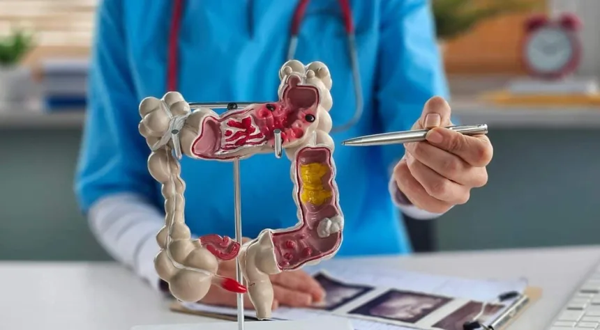 microbioma-intestinal-e-alvo-de-investigacao-sobre-cancer-colorretal-em-jovens