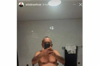 nude-publicado:-imagem-intima-de-ex-deputado-atila-lira-vaza-apos-postagem-acidental-em-rede-social