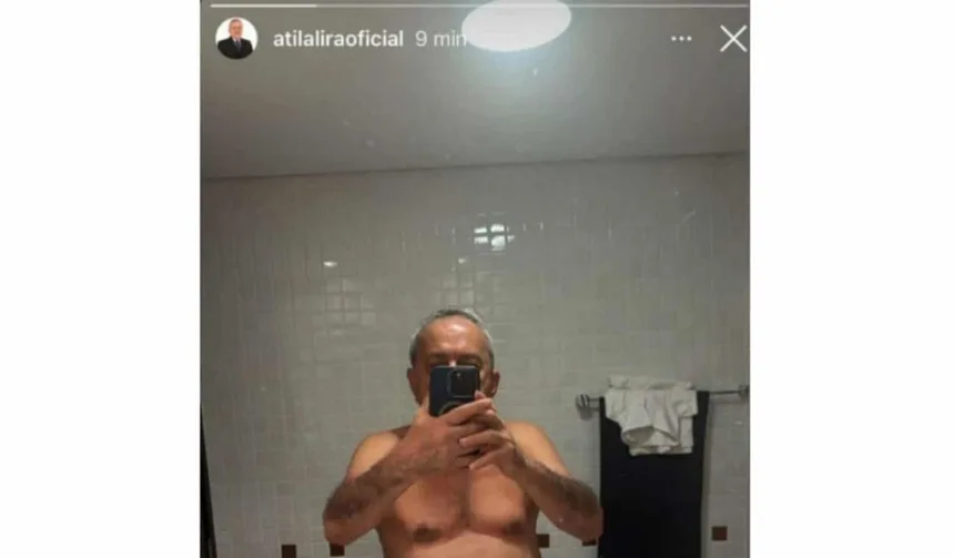 nude-publicado:-imagem-intima-de-ex-deputado-atila-lira-vaza-apos-postagem-acidental-em-rede-social
