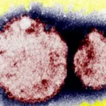 hantavirus-e-comum-em-paises-como-o-brasil-e-e-transmitido-por-roedores-silvestres