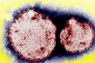 hantavirus-e-comum-em-paises-como-o-brasil-e-e-transmitido-por-roedores-silvestres