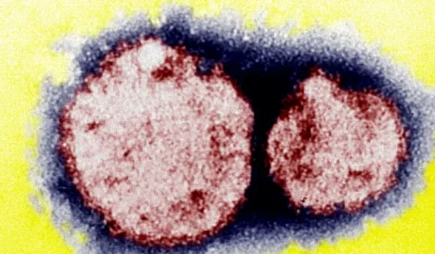 hantavirus-e-comum-em-paises-como-o-brasil-e-e-transmitido-por-roedores-silvestres