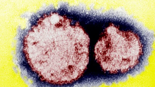 hantavirus-e-comum-em-paises-como-o-brasil-e-e-transmitido-por-roedores-silvestres