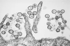 hantavirus-em-alta-na-argentina-pode-indicar-origem-do-surto-em-navio;-entenda-–-g1