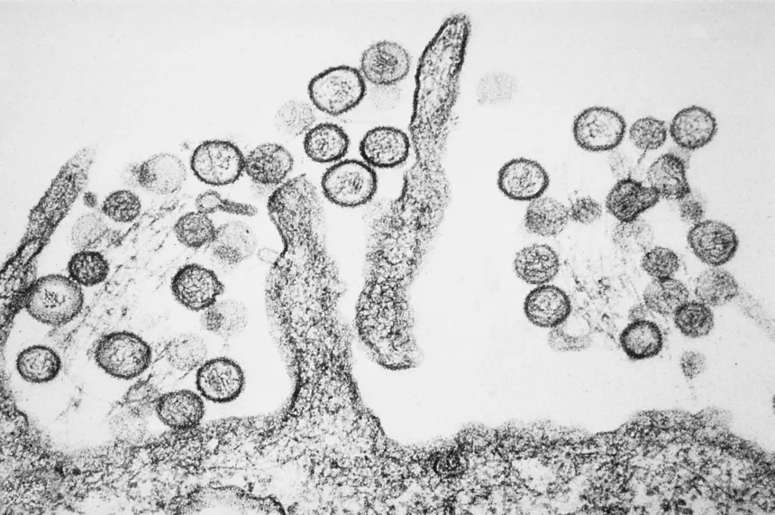 hantavirus-em-alta-na-argentina-pode-indicar-origem-do-surto-em-navio;-entenda-–-g1