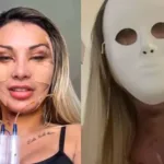 video:-andressa-urach-gasta-r$-100-mil-em-cirurgias-platicas:-“rosto-novo-apos-o-divorcio”