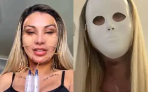 video:-andressa-urach-gasta-r$-100-mil-em-cirurgias-platicas:-“rosto-novo-apos-o-divorcio”