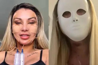 video:-andressa-urach-gasta-r$-100-mil-em-cirurgias-platicas:-“rosto-novo-apos-o-divorcio”