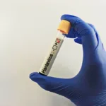 oito-casos-de-hantavirus-ligados-a-navio-que-visitou-areas-remotas-no-atlantico