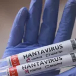 parana-confirma-dois-casos-de-hantavirus-no-estado;-11-sao-investigados-–-cnn-brasil