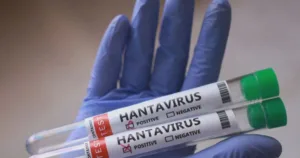 parana-confirma-dois-casos-de-hantavirus-no-estado;-11-sao-investigados-–-cnn-brasil