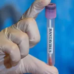 minas-gerais-confirma-uma-morte-por-hantavirus-–-cnn-brasil
