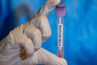 minas-gerais-confirma-uma-morte-por-hantavirus-–-cnn-brasil