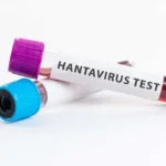 cruzeiro-com-hantavirus-chega-a-tenerife-e-acirra-tensao-entre-populacao-e-governo