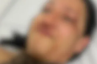mulher-denuncia-policial-militar-por-agressao-e-ameaca-em-cachoeira-dourada