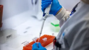 deteccao-de-variantes-de-coronavirus-no-esgoto-pode-antecipar-alta-de-internacoes-por-covid