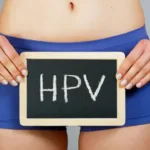 alerta:-hpv-mata-7,5-mil-por-ano-no-brasil-e-cancer-avanca-entre-jovens￼