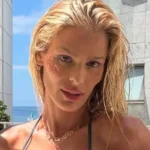 yasmin-brunet-conta-que-‘bebado-na-rua’-percebeu-lipedema-antes-dos-medicos-–-uol