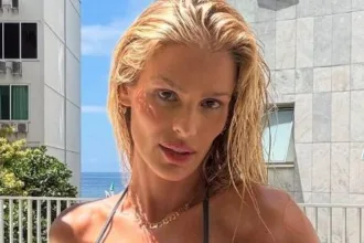 yasmin-brunet-conta-que-‘bebado-na-rua’-percebeu-lipedema-antes-dos-medicos-–-uol