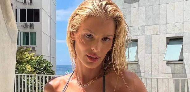 yasmin-brunet-conta-que-‘bebado-na-rua’-percebeu-lipedema-antes-dos-medicos-–-uol
