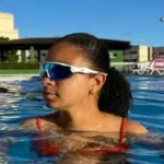 jovem-de-19-anos-perde-perna-direita-apos-ataque-de-tubarao-em-boa-viagem-no-recife