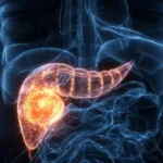 lucia-helena:-boa-noticia:-estamos-no-caminho-para-tornar-o-cancer-de-pancreas-curavel-–-uol