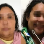 mulher-de-37-anos-presa-por-fingir-ter-12-ja-fingiu-ser-crianca-em-tratamento-em-goias