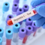 Gráfico de mortalidade por hepatite viral no SUS