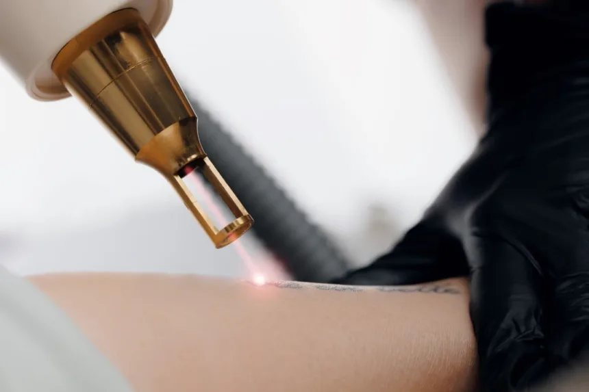 Vítima de relacionamento abusivo, holandesa processa ex-namorado e tenta remover 250 tatuagens impostas por ele 1 Goiás vence Náutico na Série B do Campeonato Brasileiro
