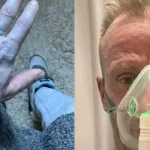 Homem com corpo azul no hospital, caso inusitado