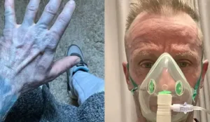 Homem com corpo azul no hospital, caso inusitado