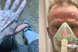 Homem com corpo azul no hospital, caso inusitado