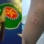 Foragido em Anápolis morde PM e é baleado durante fuga