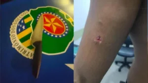 Foragido em Anápolis morde PM e é baleado durante fuga