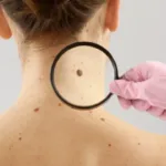 moderna-e-merck-anunciam-sucesso-de-vacina-experimental-com-mrna-contra-recidiva-do-melanoma
