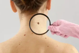 Vacina mRNA melanoma da Moderna e Merck
