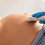 Erro médico em gravidez com curetagem realizada em feto vivo
