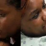 mulher-e-internada-com-‘pedra-nos-rins’-e-sai-do-hospital-com-bebe;-veja-fotos