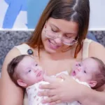 Gêmeas siamesas em preparação para cirurgia de separação