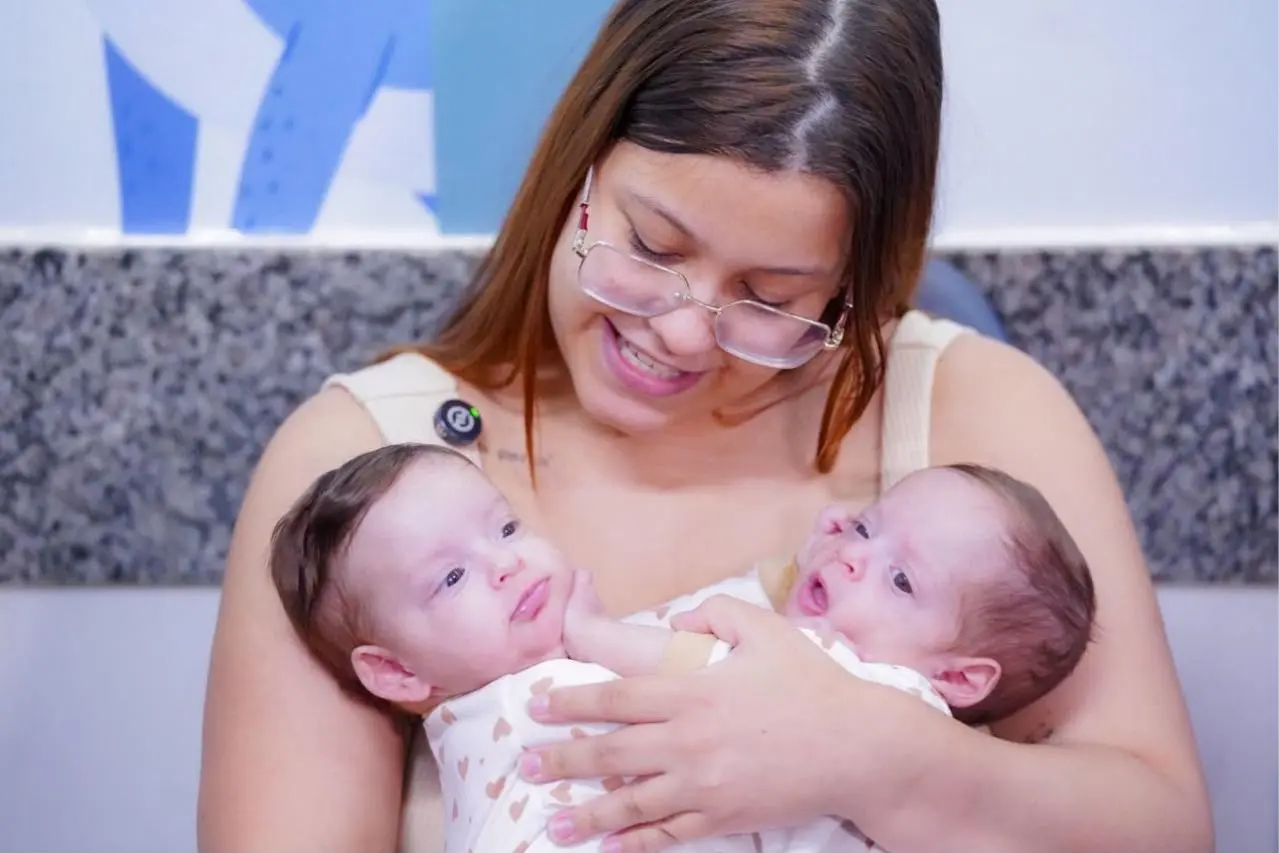 Gêmeas Siamesas em Goiânia: Avanços na Preparação para Separação