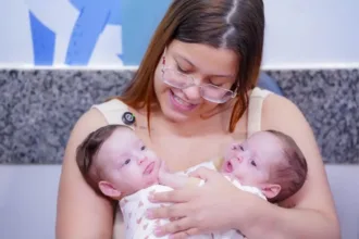 ‘alta-complexidade’:-siamesas-passarao-por-nova-cirurgia-para-preparar-separacao-em-goiania