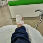Acidente com fio solto em Goiânia fere técnico de enfermagem
