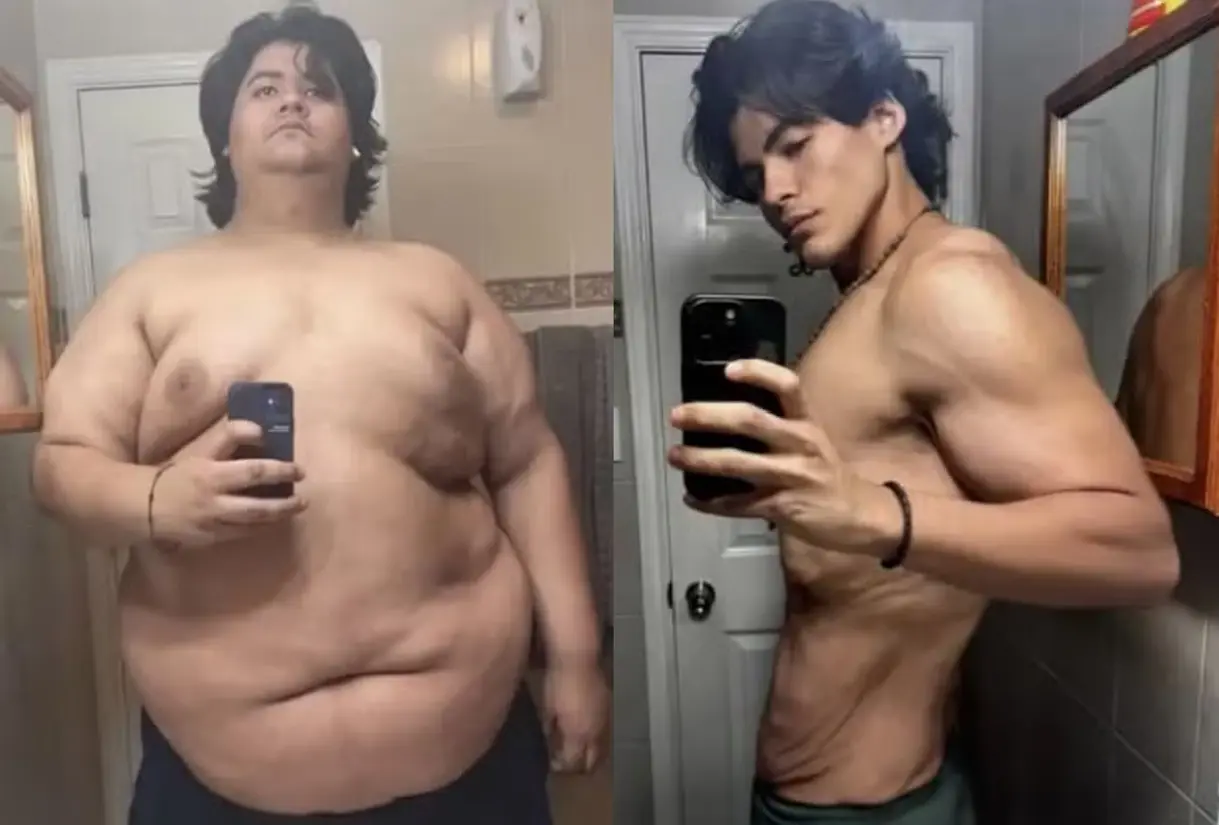 Jovem perde 124 quilos sem cirurgia nem caneta emagrecedora; veja como