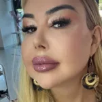 cantora-trans-relata-prazer-apos-cirurgia-de-redesignacao-sexual:-“orgasmo-intenso”