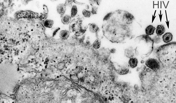 virus-htlv-1-causa-sindrome-inflamatoria-em-assintomaticos,-aponta-estudo