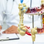 em-13-anos,-doenca-inflamatoria-intestinal-cresce-5-vezes-no-brasil