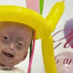 elis-lima-carneiro-morre-aos-5-anos-com-sindrome-rara-em-roraima