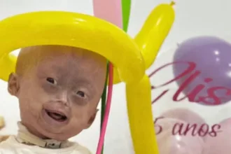elis-lima-carneiro-morre-aos-5-anos-com-sindrome-rara-em-roraima